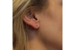  Ohrstecker - Kugel - Ø 5mm
