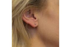  Oorstekers - Rond Zirkonia - - Ø 3mm